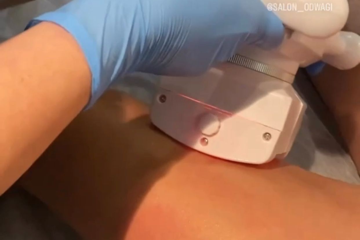 Kobieta leżąca na łóżku podczas zabiegu